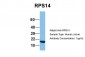 RPS14 antibody - middle region